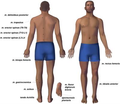 Sharp Changes in Muscle Tone in Humans Under Simulated Microgravity